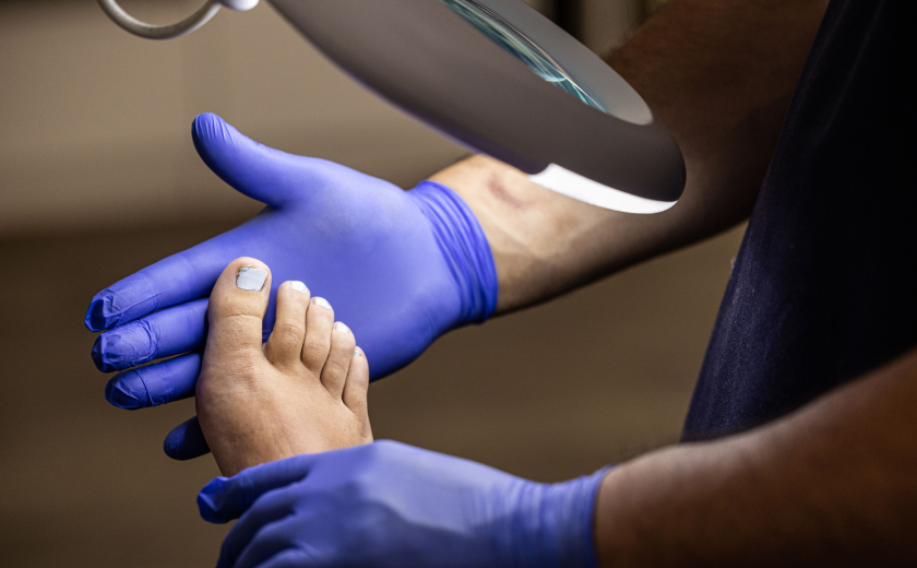 IngrownToenails