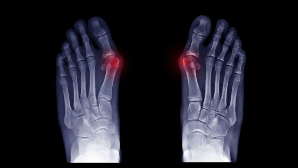Regular checks and x-rays