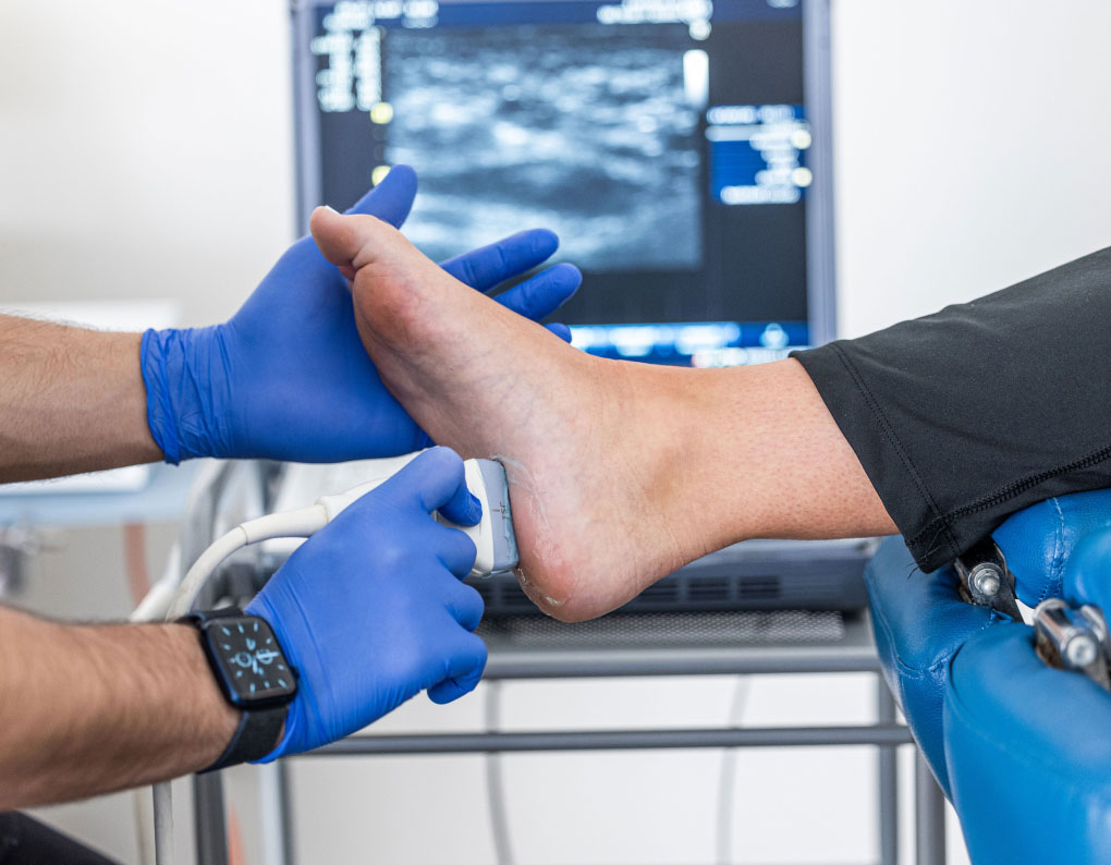 heelPain1