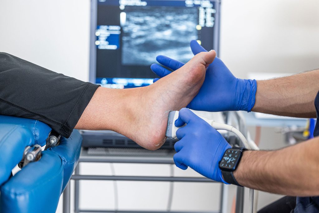 heelpain1 1