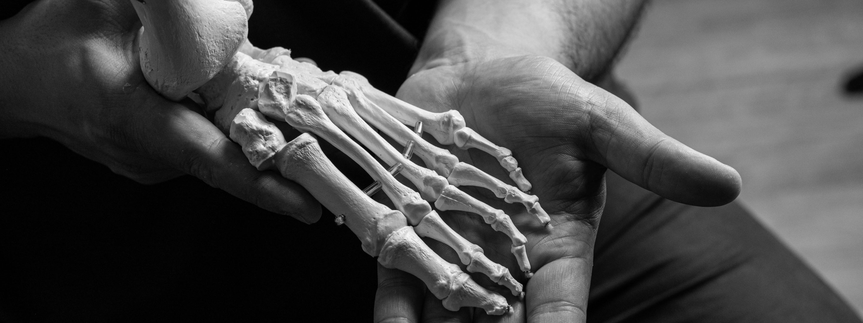 Expert Bunion Treatment Serving Gladesville, NSW