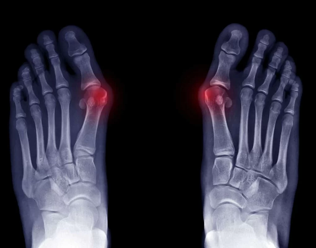 Regular checks and x-rays